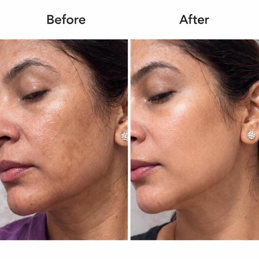 POWER OF 8 – Natural Anti-Pigmentation Serum (50ml)